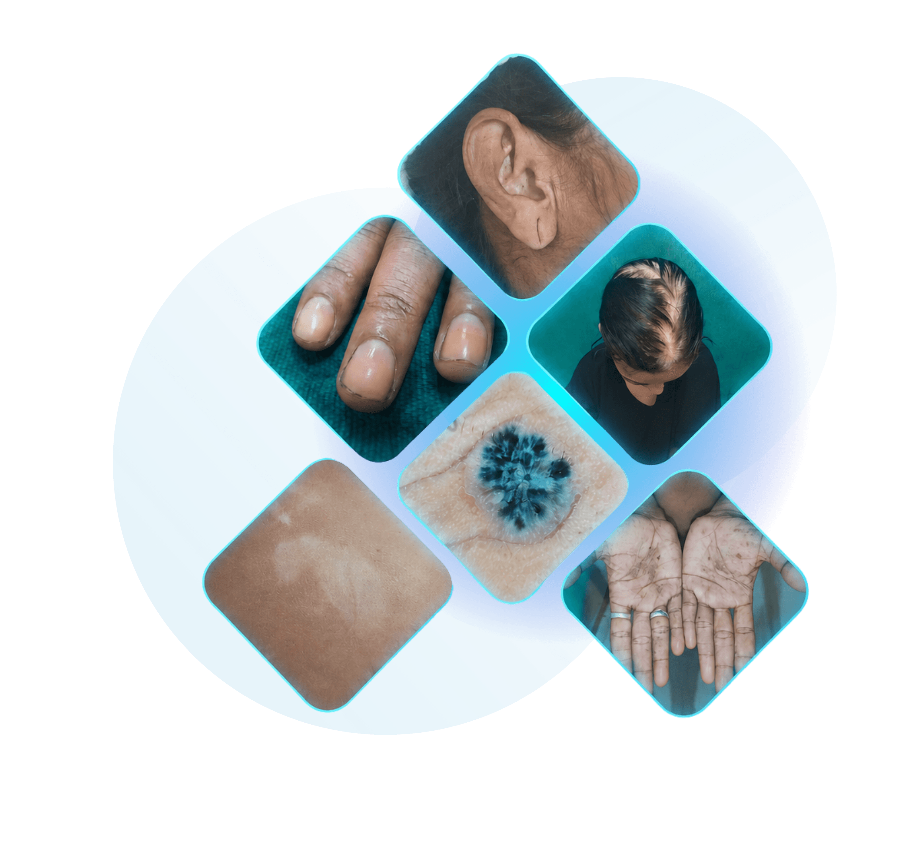 Dermatology
