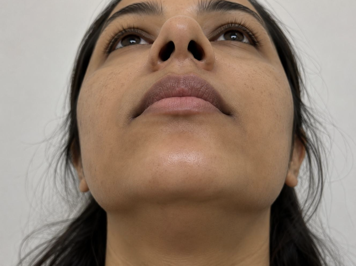 Dull looking skin